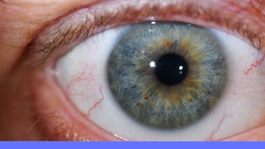 oog