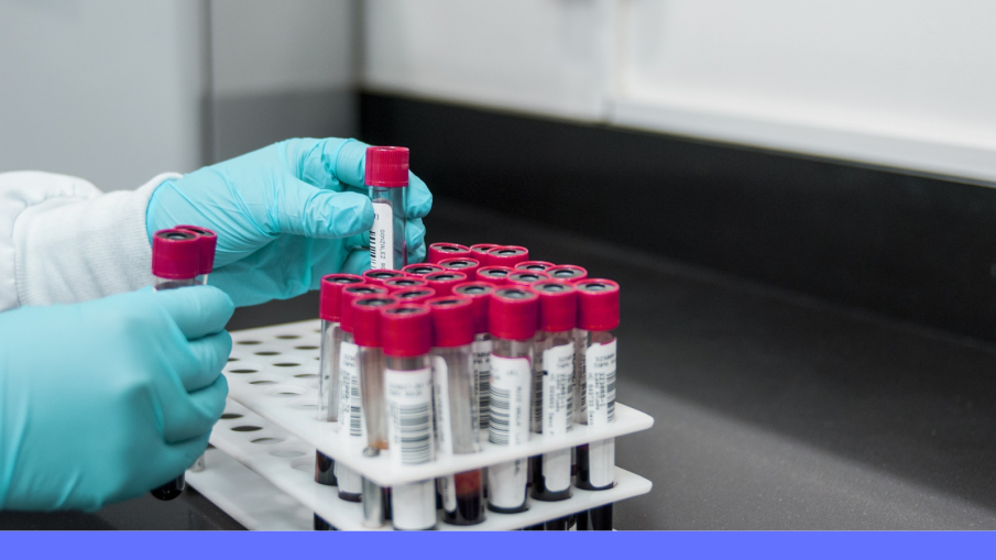 reageerbuisjes in lab