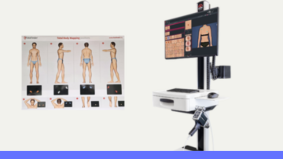 fotofinder